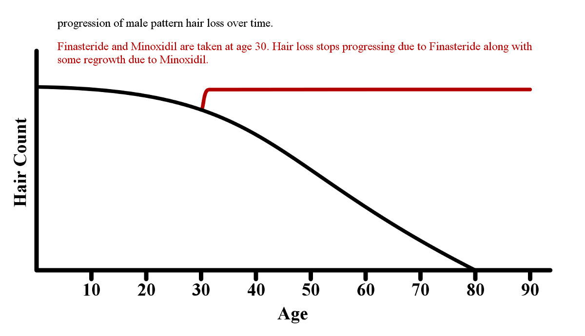 how long will it take for finasteride to work