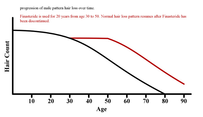 Graph demonstrating how discontinuing finasteride resumes hairless due to DHT