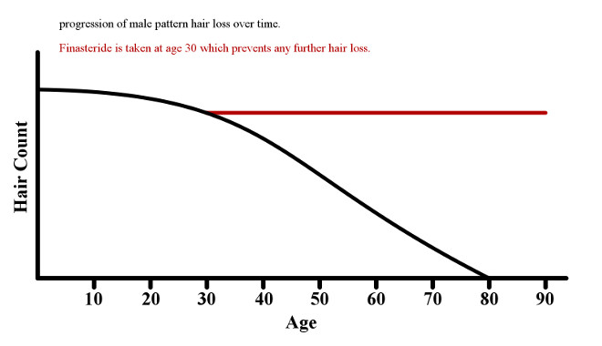 Graph of how finasteride prevents further hair loss due to DHT