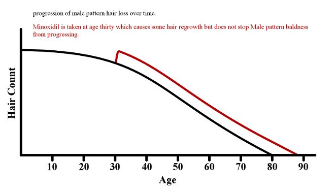 Graph of how minoxidil increases hair count