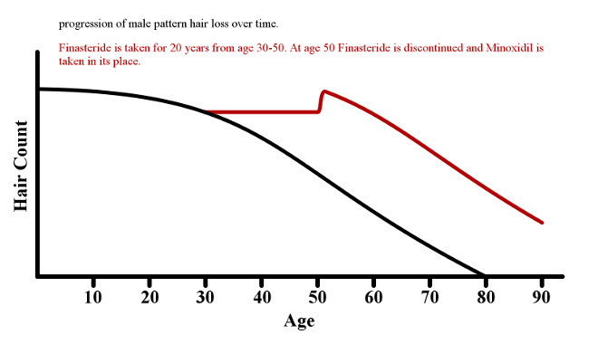 Graph of what happens when Finasteride is discontinued and Minoxidil is taken instead