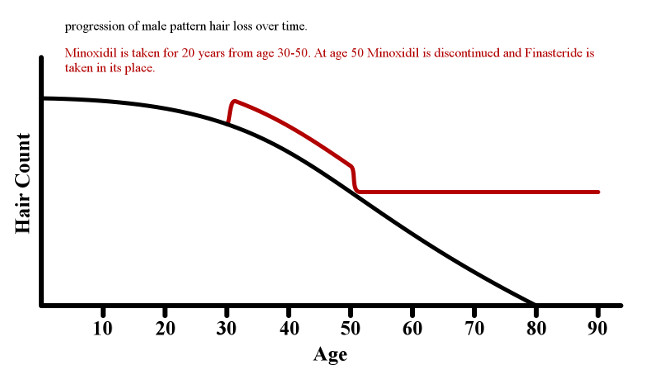 Graph of what happens when Minoxidil is discontinued and Finasteride is taken instead